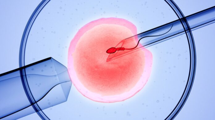 IVF