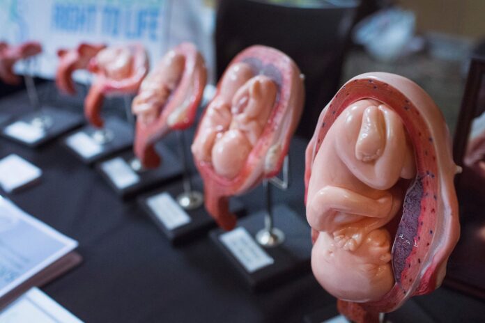 abortion abort