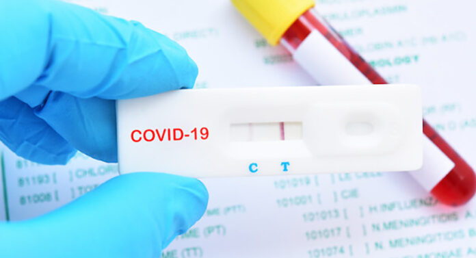 coronavirus-covid-19-test-testing
