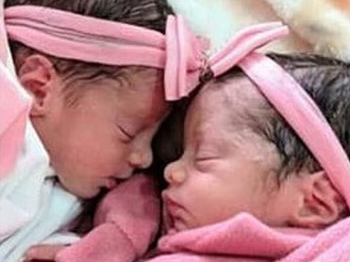 twins