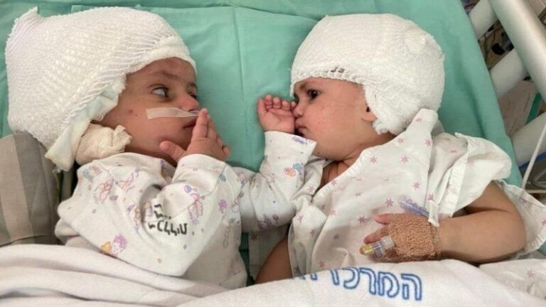 Fl-Iżrael: Tewmin jaraw lil xulxin għall-ewwel darba wara li ssirilhom operazzjoni rari