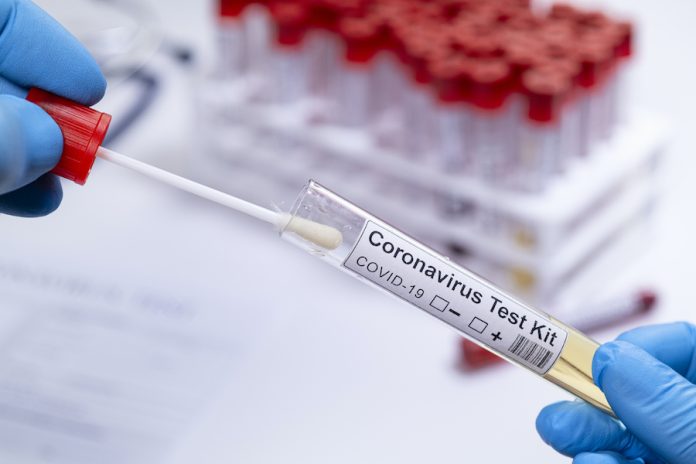 Coronavirus COVID 19 test novel corona virus healthcare worker testing samples