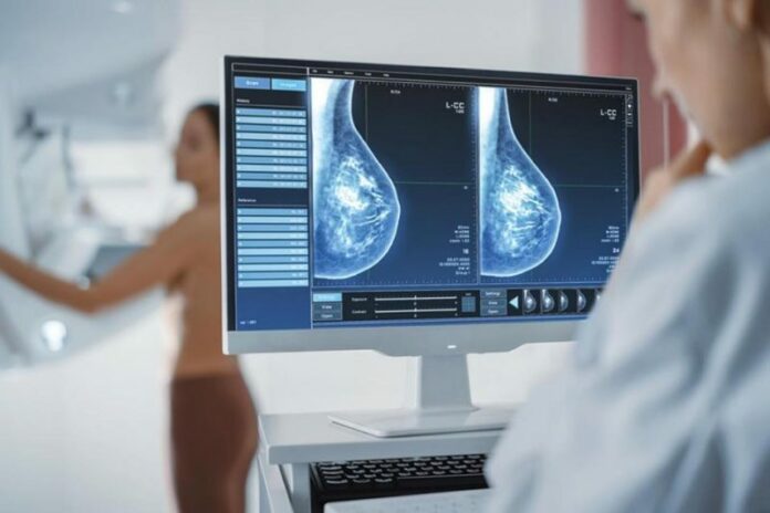 MAIN-breast-screening-1-e1701357394882